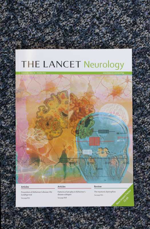 October issue of ‘The Lancet Neurology’